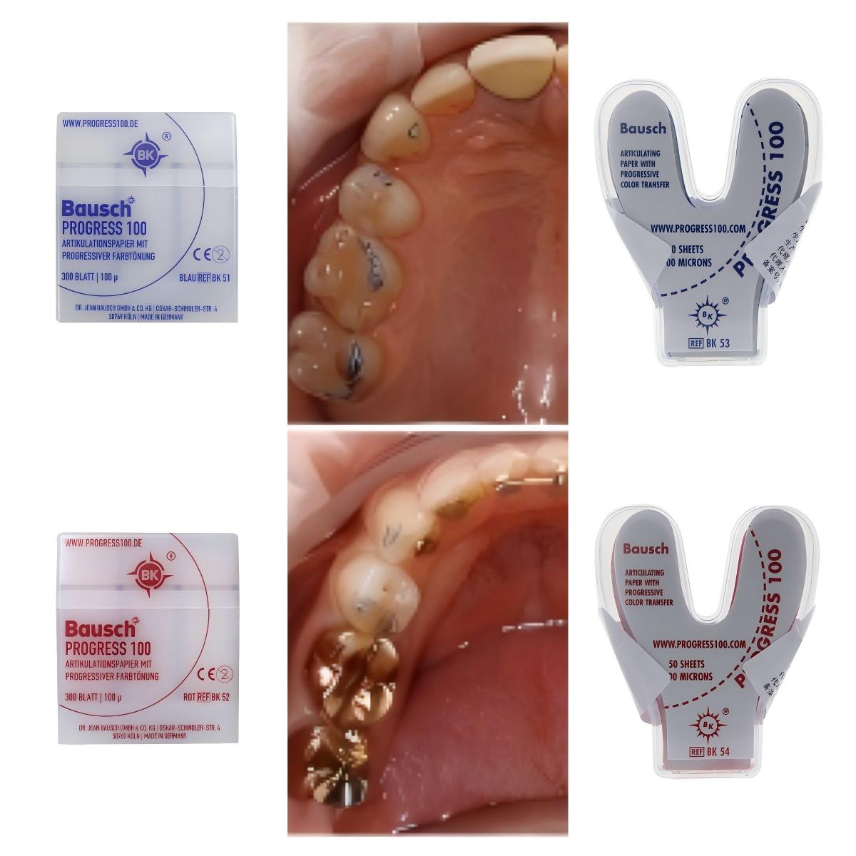 ورق تخطيط الأسنان من باوش BK51 - مراجعة Bite Indicator وسعره